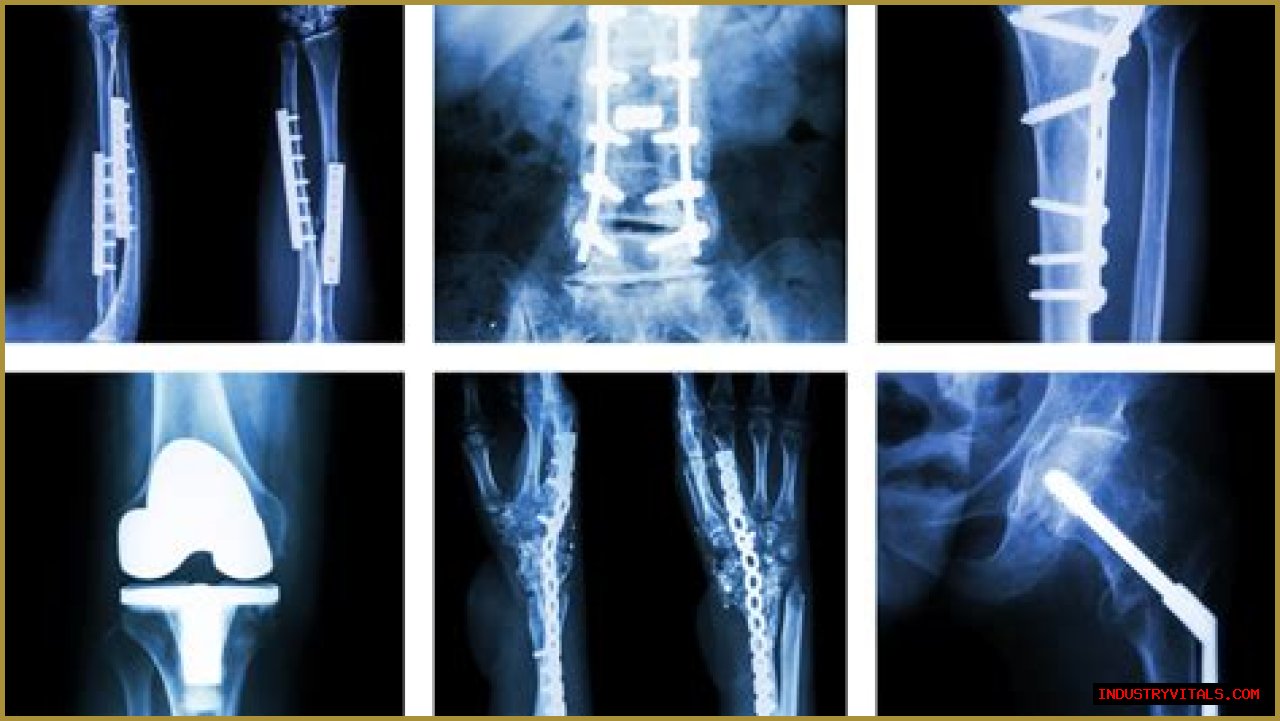 Do Orthopedic Surgeons Have Their Own Ray Machines?