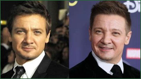 Jeremy Renner Plastic Surgery Before and After 