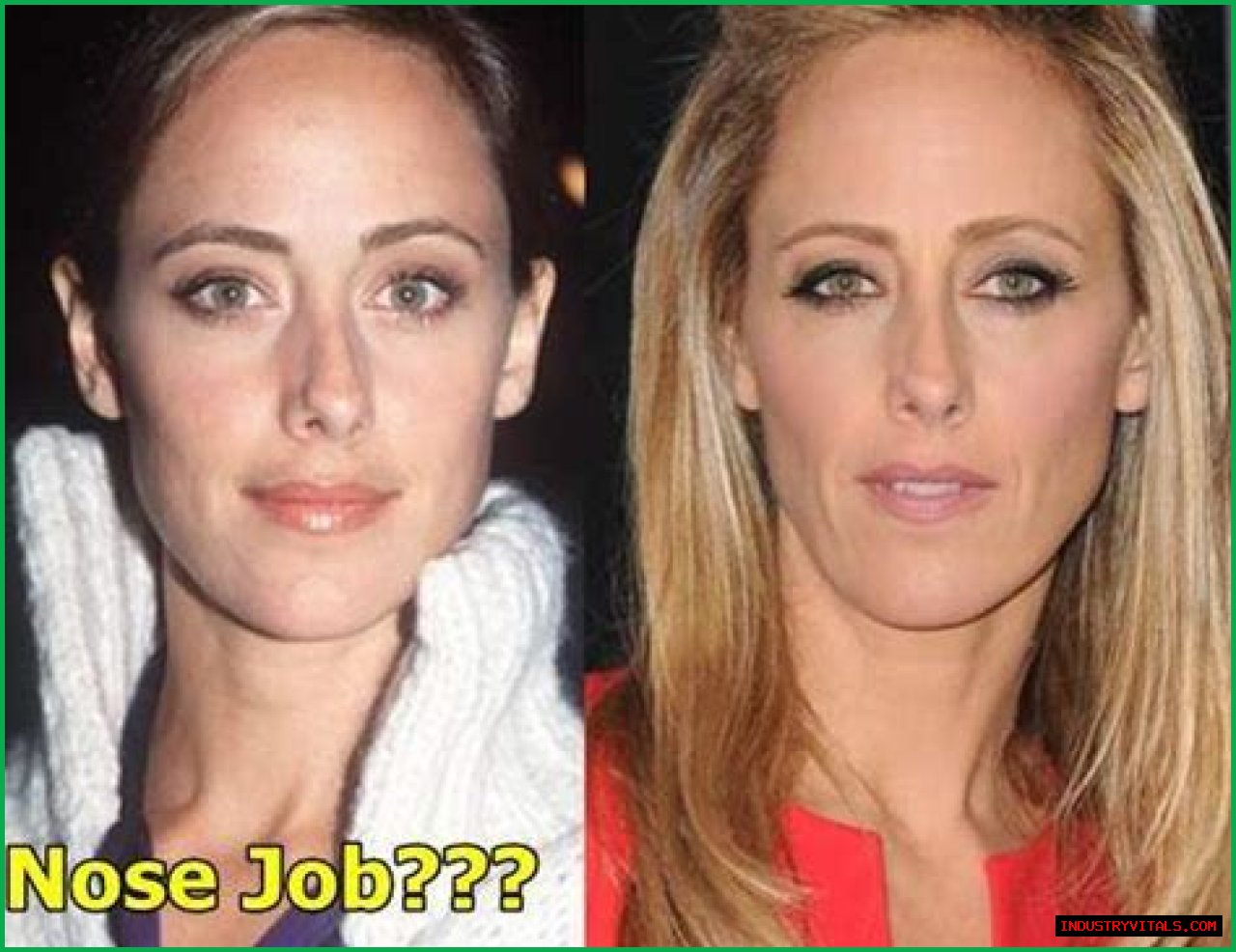 Kim Raver Plastic Surgery Before and After
